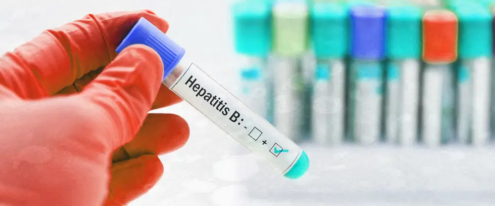 Hepatit B Nedir? Hepatit B Nasıl Bulaşır? - İlaç Hekimi